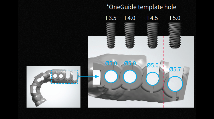 OGSCR  Osstem Guide Hole Sleeve